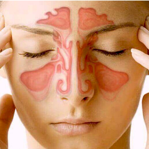 Allergy & Sinus